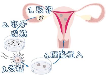 主案例